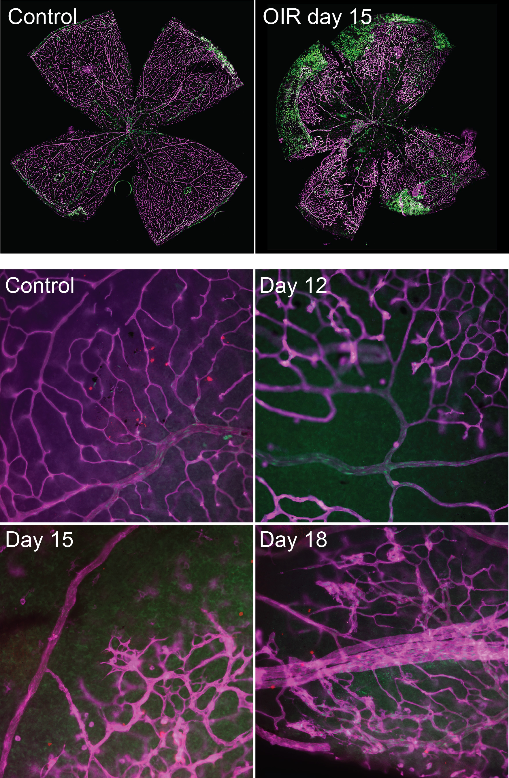 Image showing mouse retina vascular injury in an oxygen-induced retinopathy model